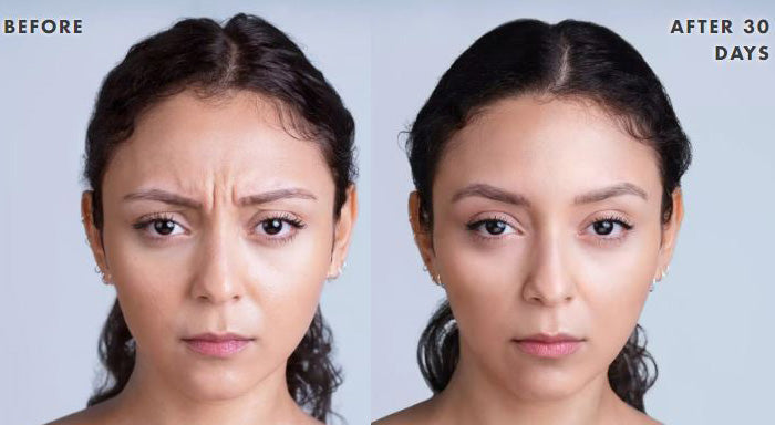 Boo-Tox Special: Botox & Xeomin (Oct 12-16 Only)
