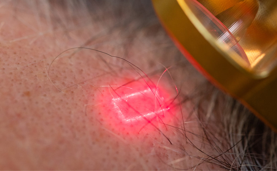 Folix Scalp Laser